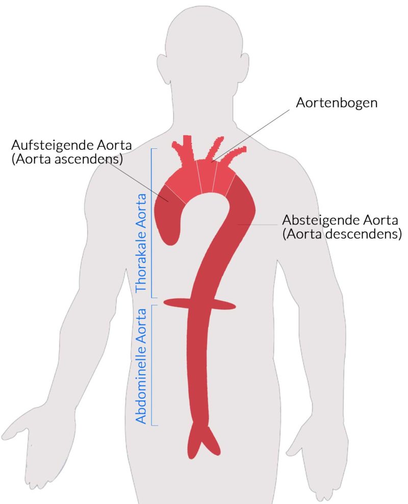 Aortenaneurysma & Aortenchirurgie - St. Gertrauden-Krankenhaus