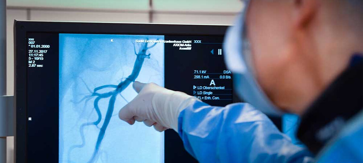 Angiologie